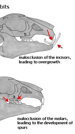 malocclusion 1 edited